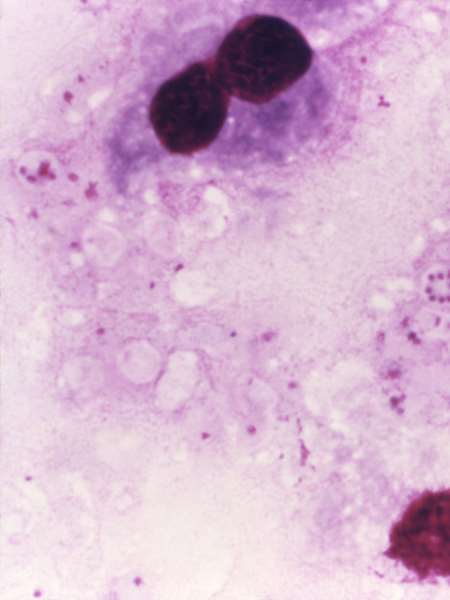 Enterobacteria phage T4 Tail fiber assembly helper protein (57) -Baculovirus