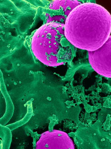 Enterobacteria phage T4 Tail fiber assembly helper protein (57) -E. coli