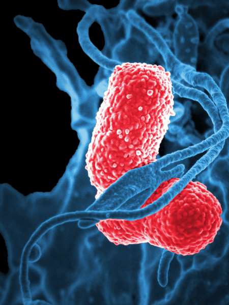 Enterobacteria phage T4 Tail fiber assembly helper protein (57) -Mammalian Cell