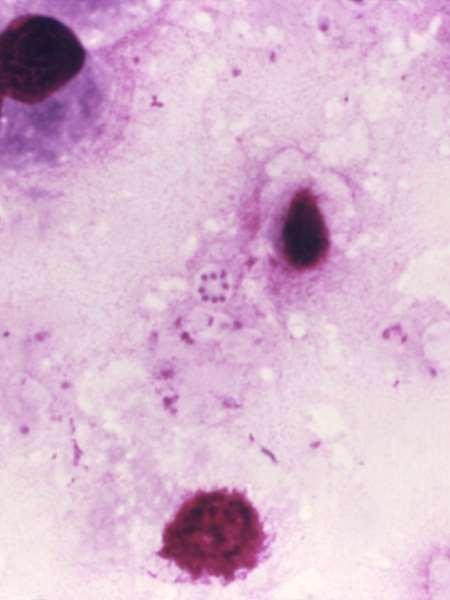 Enterobacteria phage T4 Tail fiber assembly helper protein (57) -Baculovirus
