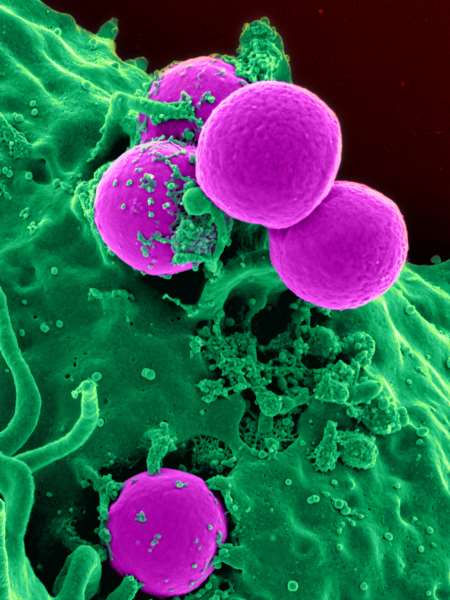 Enterobacteria phage T4 Tail fiber assembly helper protein (57) -E. coli