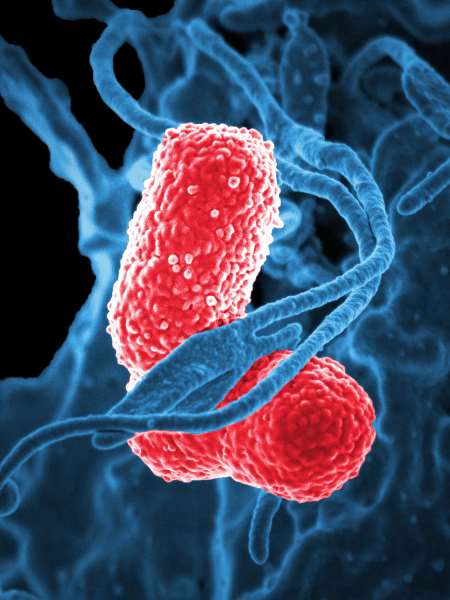 Enterobacteria phage T4 Tail fiber assembly helper protein (57) -Mammalian Cell