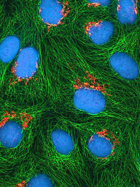 Kluyveromyces lactis Helper of Tim protein 13 (HOT13) -Yeast